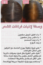 الشعر6.PNG