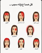 انواع الصداع 1.PNG