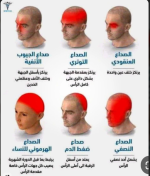 انواع الصداع.PNG