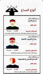 انواع الصداع5.PNG