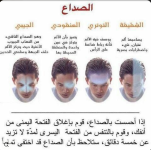 الصداع 6.PNG