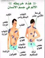 خريطة اماكـــــــــــــــــن الالم في الجسم