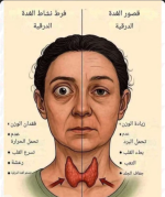 الدرقيه 2.PNG