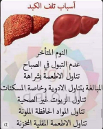 الكبد3.PNG