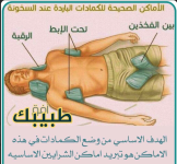 اماكن وضع الكمادات.PNG