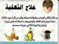 علاج الثعلبه.PNG
