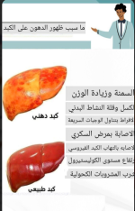 الكبد.PNG