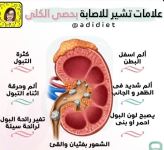 علامات حصى الكلى.PNG