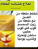 هشاشة العظام