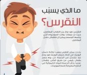 النقرس.webp