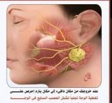 العصب السابع2.webp