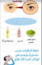 الهالات السوداء للعين.webp
