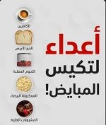 تكيس المبايض.webp