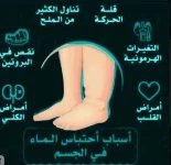 احتباس الوائل.webp