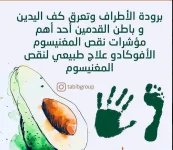 الافوكادو6.webp