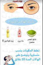 الهالات السوداء للعين.webp