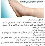 احتباس السوائل1.webp