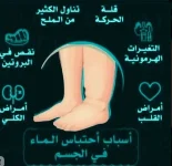 احتباس الوائل.webp