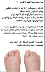 احتباس السوائل2.webp