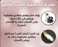 تبييض الاسنان.webp