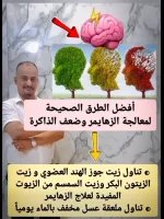 الزهايمر.webp