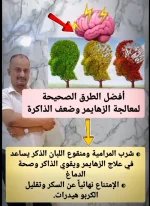 الزهايمر2.webp