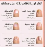 صحتك من لون ظفرك