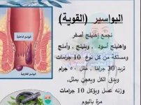 البواسير2.webp