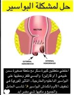 البواسير3.webp