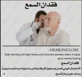 فقدان السمع.webp