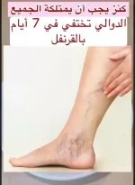 الدوالي.webp