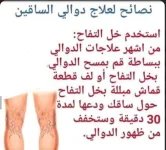 دوالي الساقين.webp