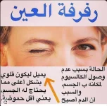 رفرفة العين