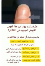 القوس الابيض في الظفر.webp
