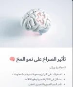 الدماغ6.webp