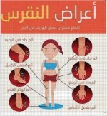اعراض النقرس.webp
