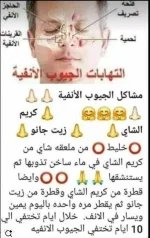 الجيوب الانفيه3.webp