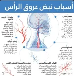 اسباب نبض عروق الرأس