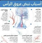 اسباب نبض عروق الرأس.webp