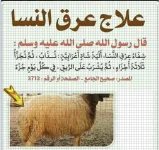 عرق النسا.webp