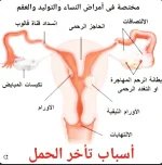 النساء خاصة.webp