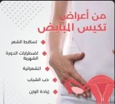للنسء9.webp