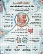 الفتق البطني.webp
