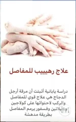 علاج رهيب للمفاصل