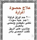 علاج حصوة المرارة.webp