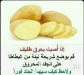 حرق بسيط.webp