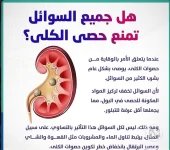 حصى الكلى.webp