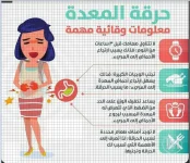 حرقة المعدة