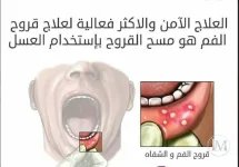 الحمو.webp