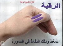 تشنج الرقبه.webp